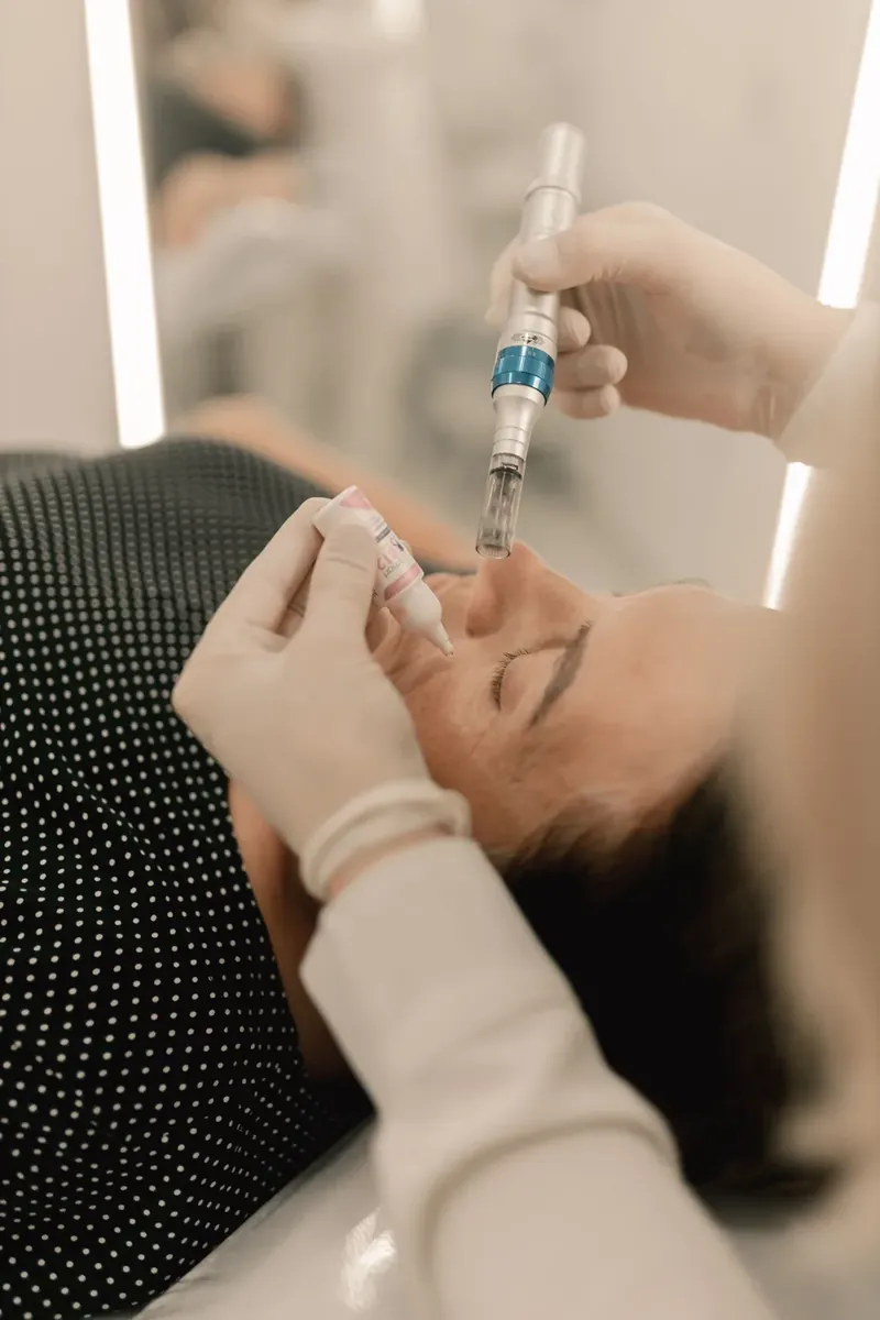 Professionelle Microneedling-Behandlung aus dem Portal Beauty Salon Oasis